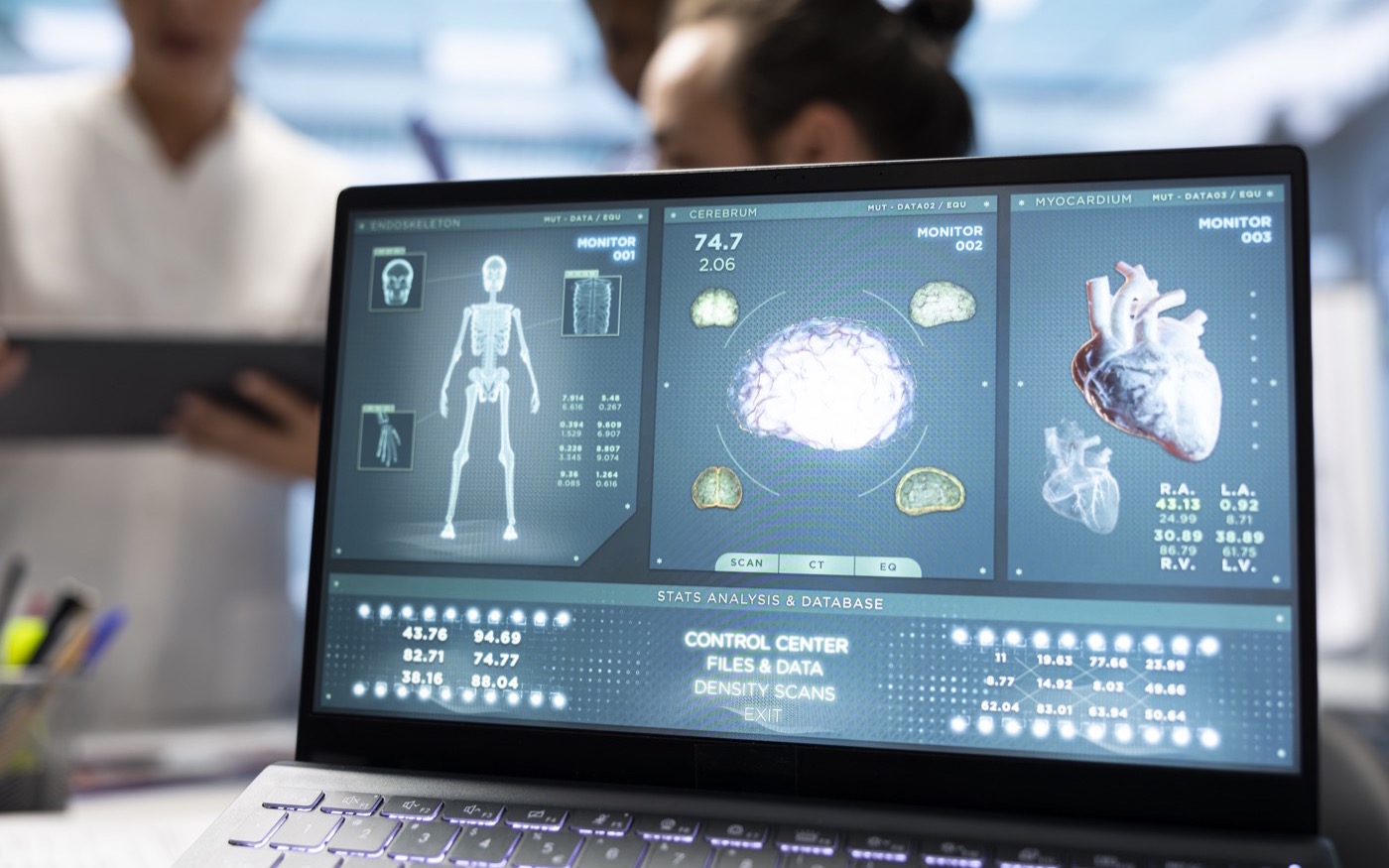Electrocardiograma